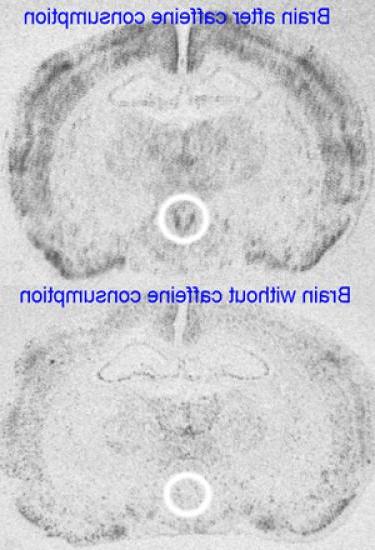 在青春期饮用咖啡因会增加下丘脑的活动(圈). 这是一个大脑区域，包含对压力源和/或生理变化作出反应的神经细胞. 研究发现，这一大脑区域的活动增加与焦虑增加有关, 即使在停止饮用咖啡因之后. 图片由瑞安Bachtell提供.